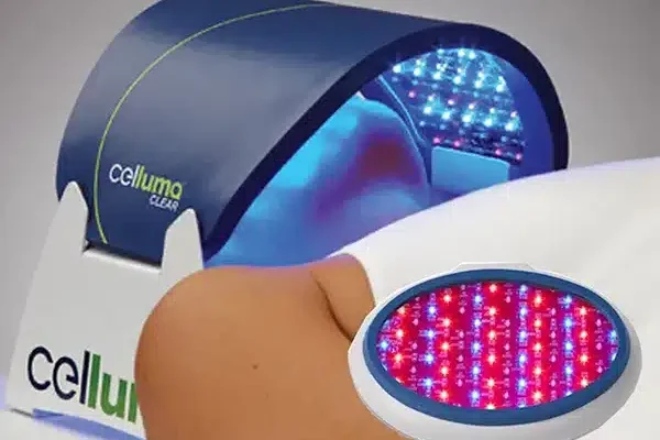 TERAPIA DE LUZ CELLUMA TERAPIA DE LUZ CELLUMA